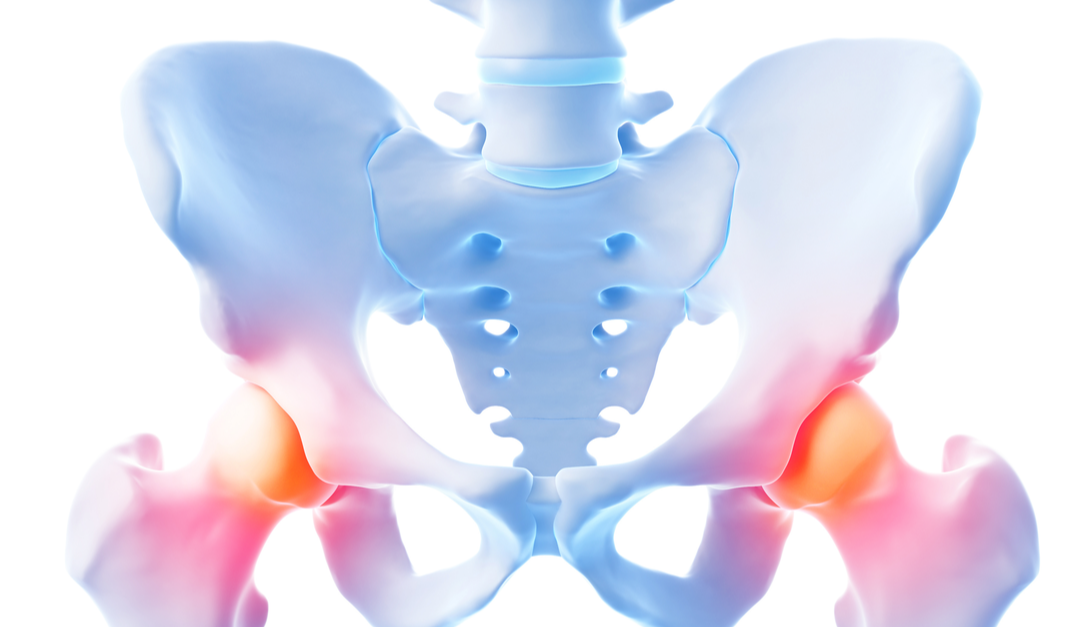3 Common Hip Injuries and How to Treat Them Mahwah Valley